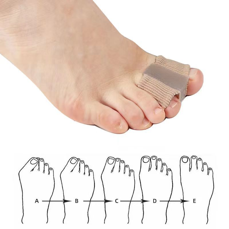 Fiber Toe Separator | Ergonomic Toe Alignment & Foot Care Tool
